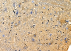 Invitrogen KCNF1 Polyclonal Antibody 100 &mu;L; Unconjugated:Antibodies,