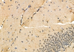 Invitrogen KCNH1 Polyclonal Antibody 100 &mu;L; Unconjugated:Antibodies,