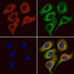 Invitrogen KCNQ5 Polyclonal Antibody 100 &mu;L; Unconjugated:Antibodies,