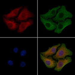 Invitrogen ZDHHC20 Polyclonal Antibody 100 &mu;L; Unconjugated:Antibodies,