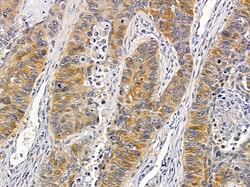 Invitrogen ZDHHC20 Polyclonal Antibody 100 &mu;L; Unconjugated:Antibodies,