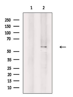 Invitrogen POTEB Polyclonal Antibody 100 &mu;L; Unconjugated:Antibodies,