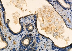 Invitrogen NDRG4 Polyclonal Antibody 100 &mu;L; Unconjugated:Antibodies,