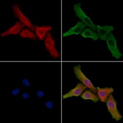 Invitrogen PPP1R16B Polyclonal Antibody 100 &mu;L; Unconjugated:Antibodies,