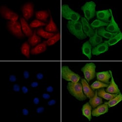 Invitrogen PPP1R14D Polyclonal Antibody 100 &mu;L; Unconjugated:Antibodies,