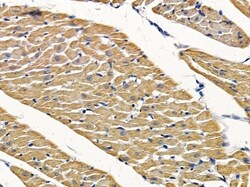 Invitrogen PPP1R14D Polyclonal Antibody 100 &mu;L; Unconjugated:Antibodies,