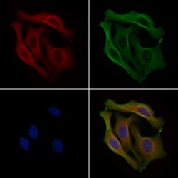 Invitrogen PPP1R3A Polyclonal Antibody 100 &mu;L; Unconjugated:Antibodies,