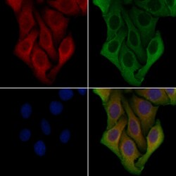 Invitrogen PPP1R3C Polyclonal Antibody 100 &mu;L; Unconjugated:Antibodies,