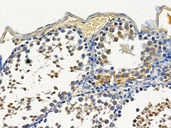 Invitrogen PPP1R3C Polyclonal Antibody 100 &mu;L; Unconjugated:Antibodies,