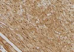 Invitrogen SSH3 Polyclonal Antibody 100 &mu;L; Unconjugated:Antibodies,