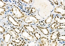 Invitrogen SSH3 Polyclonal Antibody 100 &mu;L; Unconjugated:Antibodies,
