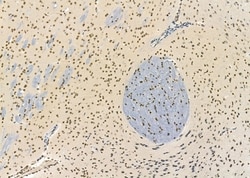 Invitrogen SSH3 Polyclonal Antibody 100 &mu;L; Unconjugated:Antibodies,