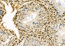 Invitrogen SSH3 Polyclonal Antibody 100 &mu;L; Unconjugated:Antibodies,