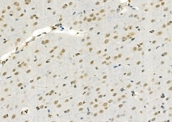 Invitrogen SSH3 Polyclonal Antibody 100 &mu;L; Unconjugated:Antibodies,
