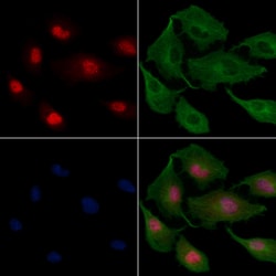 Invitrogen RED Polyclonal Antibody 100 &mu;L; Unconjugated:Antibodies,