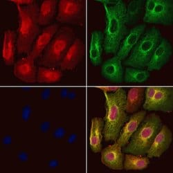 Invitrogen S100A16 Polyclonal Antibody 100 &mu;L; Unconjugated:Antibodies,