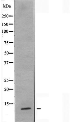 Invitrogen S100Z Polyclonal Antibody 100 &mu;L; Unconjugated:Antibodies,