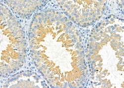 Invitrogen PDXDC1 Polyclonal Antibody 100 &mu;L; Unconjugated:Antibodies,