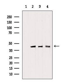 Invitrogen PDHA1 Polyclonal Antibody 100 &mu;L; Unconjugated:Antibodies,