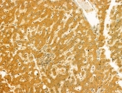 Invitrogen RAB3GAP2 Polyclonal Antibody 100 &mu;L; Unconjugated:Antibodies,