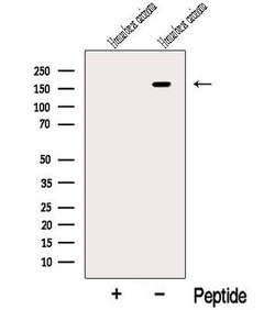 Invitrogen RAB3GAP2 Polyclonal Antibody 100 &mu;L; Unconjugated:Antibodies,