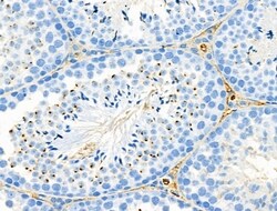 Invitrogen RANBP17 Polyclonal Antibody 100 &mu;L; Unconjugated:Antibodies,