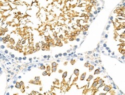 Invitrogen RANBP17 Polyclonal Antibody 100 &mu;L; Unconjugated:Antibodies,