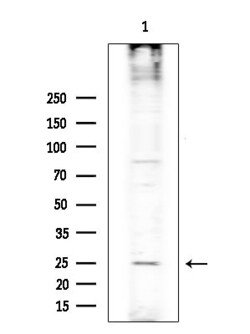 Invitrogen RASL10A Polyclonal Antibody 100 &mu;L; Unconjugated:Antibodies,