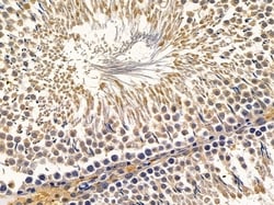 RRAGC Polyclonal Antibody:Antibodies, Polyclonal