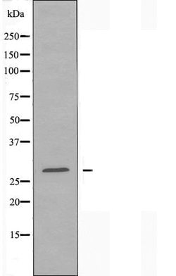 Invitrogen RAB18 Polyclonal Antibody 100 &mu;L; Unconjugated:Antibodies,