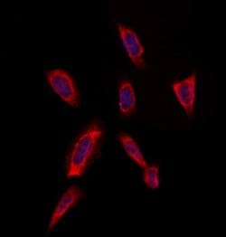 Invitrogen RAB20 Polyclonal Antibody 100 &mu;L; Unconjugated:Antibodies,