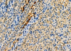 Invitrogen RAB20 Polyclonal Antibody 100 &mu;L; Unconjugated:Antibodies,