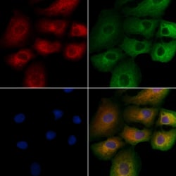 Invitrogen RAB2B Polyclonal Antibody 100 &mu;L; Unconjugated:Antibodies,