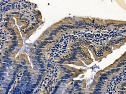 Invitrogen RAB31 Polyclonal Antibody 100 &mu;L; Unconjugated:Antibodies,