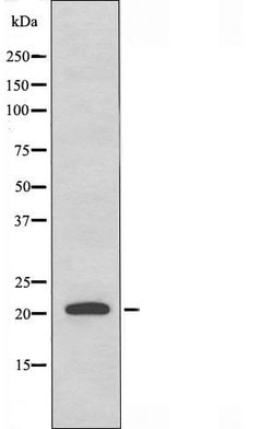 Invitrogen RAB31 Polyclonal Antibody 100 &mu;L; Unconjugated:Antibodies,