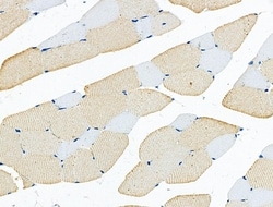Invitrogen RAP2C Polyclonal Antibody 100 &mu;L; Unconjugated:Antibodies,