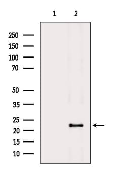 Invitrogen RGS5 Polyclonal Antibody 100 &mu;L; Unconjugated:Antibodies,