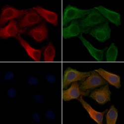 Invitrogen RGS7 Polyclonal Antibody 100 &mu;L; Unconjugated:Antibodies,
