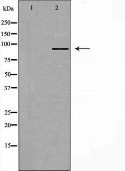 Invitrogen RPTN Polyclonal Antibody 100 &mu;L | Buy Online | Invitrogen&trade; | Fisher Scientific