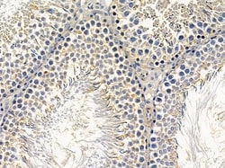 ARHGAP17 Polyclonal Antibody 100 &mu;L | Buy Online | Thermo Scientific | Fisher Scientific