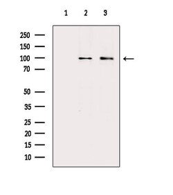 ARHGAP17 Polyclonal Antibody 100 &mu;L | Buy Online | Thermo Scientific | Fisher Scientific