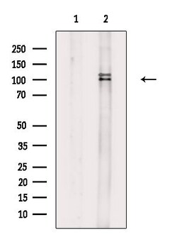 ARHGAP17 Polyclonal Antibody 100 &mu;L | Buy Online | Thermo Scientific | Fisher Scientific
