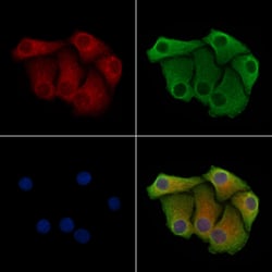 Invitrogen ARHGAP9 Polyclonal Antibody 100 &mu;L | Buy Online | Invitrogen&trade; | Fisher Scientific