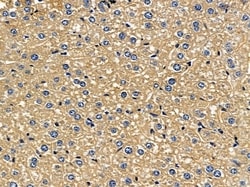 Invitrogen ARHGAP9 Polyclonal Antibody 100 &mu;L | Buy Online | Invitrogen&trade; | Fisher Scientific