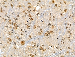 Invitrogen ARHGEF7 Polyclonal Antibody 100 &mu;L; Unconjugated:Antibodies,