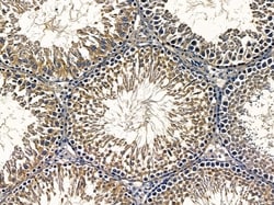 Invitrogen RIMKLA Polyclonal Antibody 100 &mu;L; Unconjugated:Antibodies,