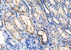 Invitrogen SPINK5 Polyclonal Antibody 100 &mu;L; Unconjugated:Antibodies,