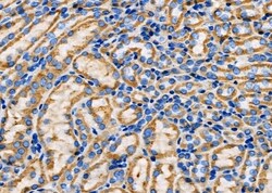 Invitrogen SPINK5 Polyclonal Antibody 100 &mu;L; Unconjugated:Antibodies,