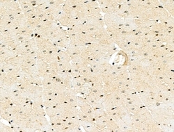 Invitrogen NEK7 Polyclonal Antibody 100 &mu;L | Buy Online | Invitrogen&trade; | Fisher Scientific