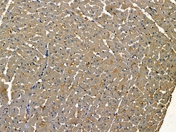 Invitrogen PLK2 Polyclonal Antibody 100 &mu;L; Unconjugated:Antibodies,